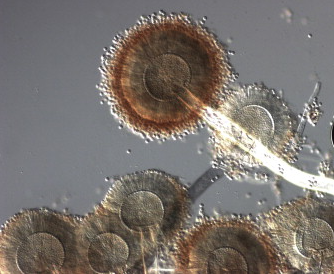 Gray mold as seen under the microscope.